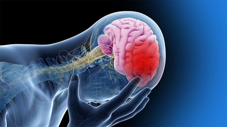 La hipertensión arterial es responsable del 88% de los ACV en Argentina