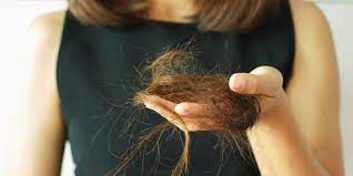 Caída del pelo, un síntoma poco conocido post Covid 19
