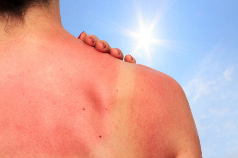 Los cuidados del sol y riesgos de la piel