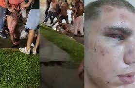Río Tercero: brutal golpiza a un adolescente de 17 años a la salida de un boliche